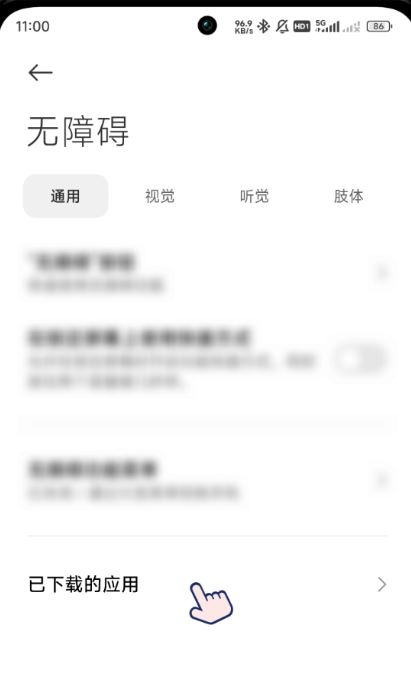 SKIP(图2)